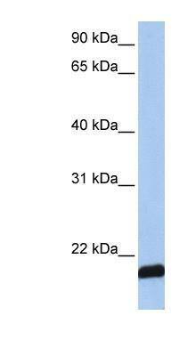 Western Blot: ARF6 Antibody [NBP1-58310]