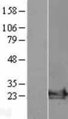 Western Blot: ARF6 Overexpression Lysate [NBL1-07654]