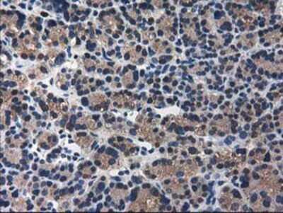 Immunohistochemistry-Paraffin: ARFGAP1 Antibody (OTI1F6) [NBP2-00513]