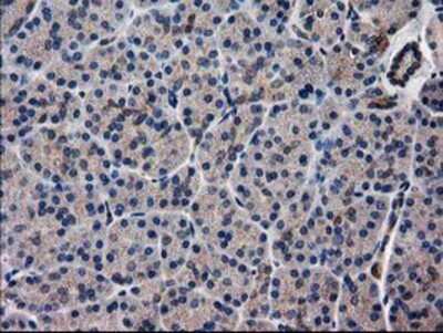 Immunohistochemistry-Paraffin: ARFGAP1 Antibody (OTI1F6) [NBP2-00513]