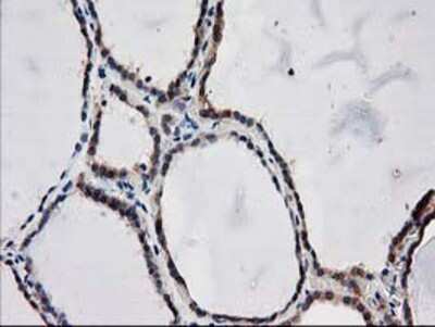 Immunohistochemistry-Paraffin: ARFGAP1 Antibody (OTI1F6) [NBP2-00513]