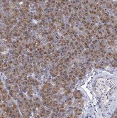 Immunohistochemistry-Paraffin: ARFGAP1 Antibody [NBP2-14305]