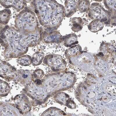 Immunohistochemistry-Paraffin: ARFGAP1 Antibody [NBP2-14305]