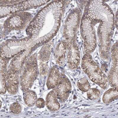 Immunohistochemistry-Paraffin: ARFGAP1 Antibody [NBP2-14305]