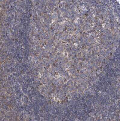 Immunohistochemistry-Paraffin: ARFGAP1 Antibody [NBP2-14305]