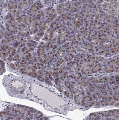 Immunohistochemistry-Paraffin: ARFGAP1 Antibody [NBP2-38787]