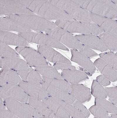 Immunohistochemistry-Paraffin: ARFGAP1 Antibody [NBP2-38787]