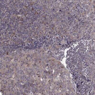 Immunohistochemistry-Paraffin: ARFGAP1 Antibody [NBP2-38787]