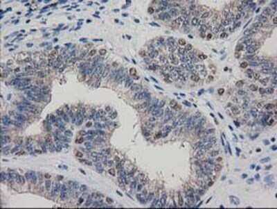 Immunohistochemistry: ARFGAP1 Antibody (OTI1F6) - Azide and BSA Free [NBP2-72013]