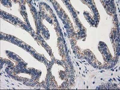 Immunohistochemistry: ARFGAP1 Antibody (OTI1F6) - Azide and BSA Free [NBP2-72013]
