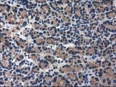 Immunohistochemistry: ARFGAP1 Antibody (OTI1F6) - Azide and BSA Free [NBP2-72013]