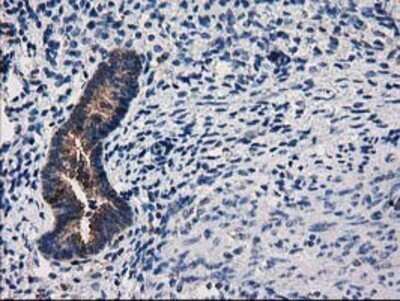 Immunohistochemistry: ARFGAP1 Antibody (OTI1F6) - Azide and BSA Free [NBP2-72013]