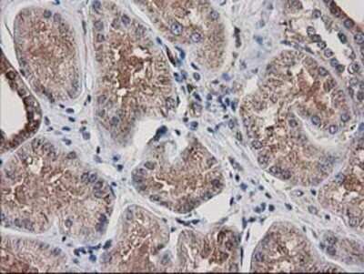 Immunohistochemistry: ARFGAP1 Antibody (OTI1F6) - Azide and BSA Free [NBP2-72013]
