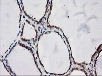 Immunohistochemistry: ARFGAP1 Antibody (OTI1F6) - Azide and BSA Free [NBP2-72013]