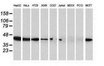 Western Blot: ARFGAP1 Antibody (OTI1F6)Azide and BSA Free [NBP2-72013]