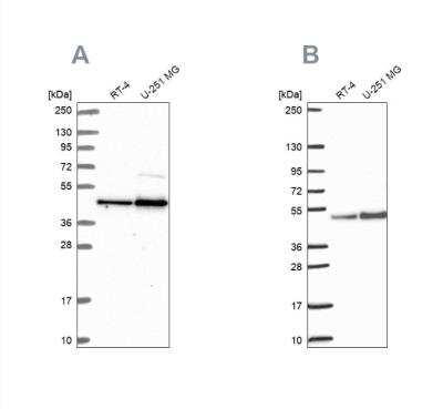 Western Blot: ARFGAP1 Antibody [NBP2-14305]