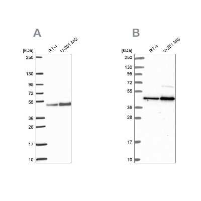 Western Blot: ARFGAP1 Antibody [NBP2-38787]