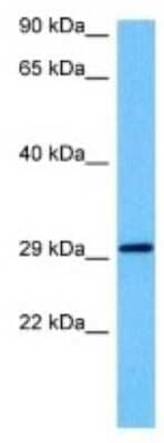 Western Blot: ARFGAP1 Antibody [NBP3-10814]