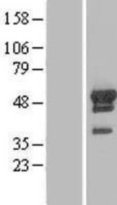 Western Blot: ARFGAP1 Overexpression Lysate [NBL1-07655]