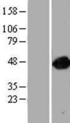 Western Blot: ARFGAP1 Overexpression Lysate [NBP2-06850]