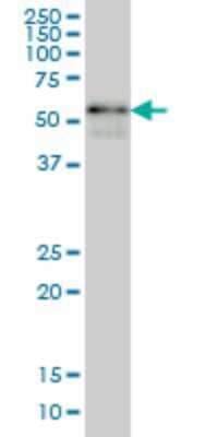 Western Blot: ARFGAP2 Antibody (4B3) [H00084364-M03]