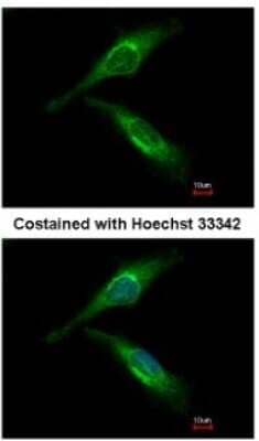 Immunocytochemistry/ Immunofluorescence: ARFGAP2 Antibody [NBP2-15441]
