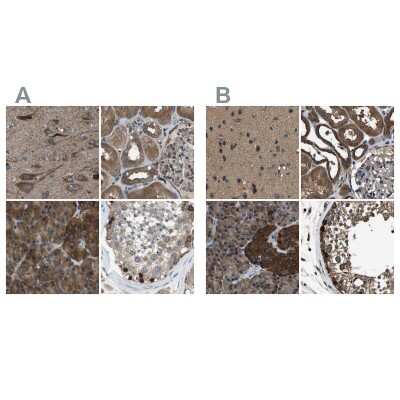 Immunohistochemistry-Paraffin: ARFGAP2 Antibody [NBP1-83687]