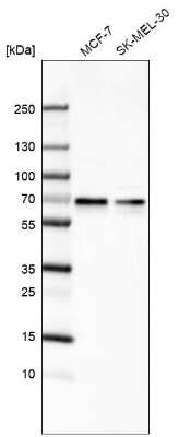 Western Blot: ARFGAP2 Antibody [NBP1-83687]