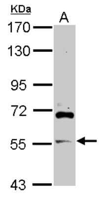 Western Blot: ARFGAP2 Antibody [NBP2-15441]