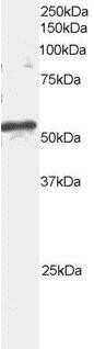 Western Blot: ARFGAP3 Antibody [NB100-843]