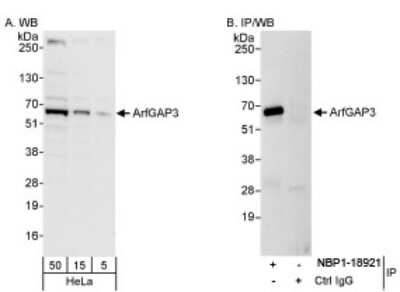 Western Blot: ARFGAP3 Antibody [NBP1-18921]