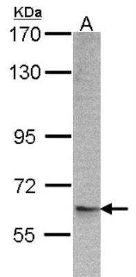 Western Blot: ARFGAP3 Antibody [NBP1-31064]