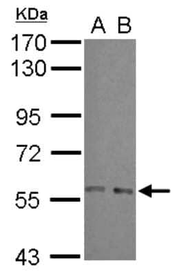 Western Blot: ARFGAP3 Antibody [NBP2-15442]