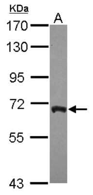 Western Blot: ARFGAP3 Antibody [NBP2-15443]