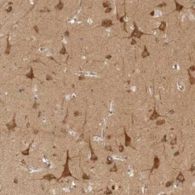 Immunohistochemistry-Paraffin: ARFGEF1 Antibody [NBP1-88840]