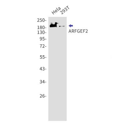 Western Blot: ARFGEF2 Antibody (S07-7H7) [NBP3-19573]