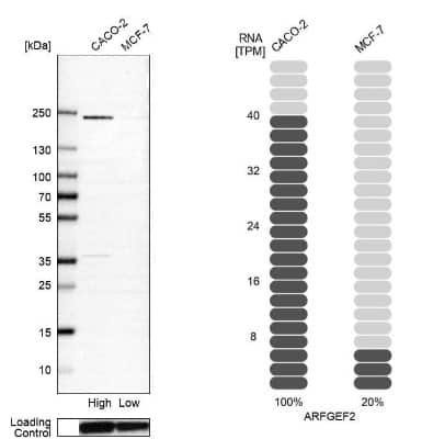 Western Blot: ARFGEF2 Antibody [NBP1-88607]