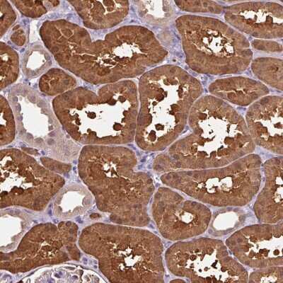 Immunohistochemistry: ARFIP1 Antibody [NBP2-38342]