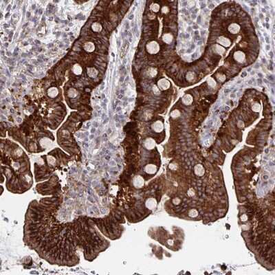 Immunohistochemistry: ARFIP1 Antibody [NBP2-39002]