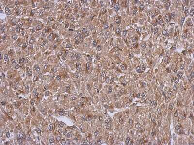 Immunohistochemistry-Paraffin: ARFIP1 Antibody [NBP2-15444]