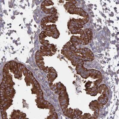 Immunohistochemistry-Paraffin: ARFIP1 Antibody [NBP2-39002]