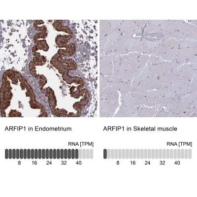 Immunohistochemistry-Paraffin: ARFIP1 Antibody [NBP2-39002]