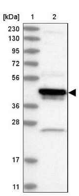 Western Blot: ARFIP1 Antibody [NBP2-38342]