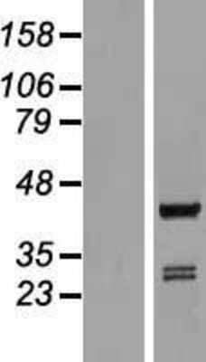 Western Blot: ARFIP1 Overexpression Lysate [NBL1-07658]