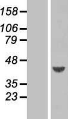 Western Blot: ARFIP1 Overexpression Lysate [NBP2-07334]