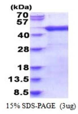 SDS-PAGE: Recombinant Human ARFIP1 His Protein [NBP2-51834]