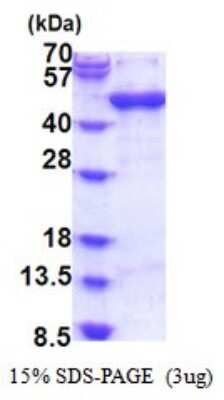 SDS-PAGE: Recombinant Human ARFIP1 His Protein [NBP2-51835]