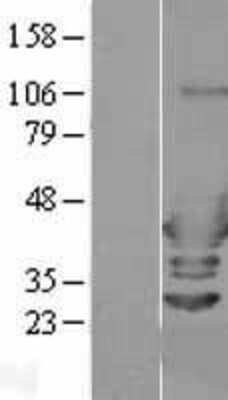 Western Blot: ARFIP2 Overexpression Lysate [NBL1-07660]