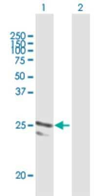 Western Blot: ARFRP1 Antibody [H00010139-B03P]