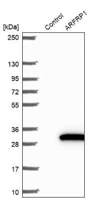 Western Blot: ARFRP1 Antibody [NBP2-14306]